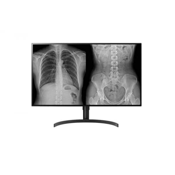 Monitor LG 32" 32HL710S-W Cirúrgico